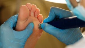 Professional Foot Care Winnipeg