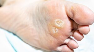 In-Home Pedicure Winnipeg
